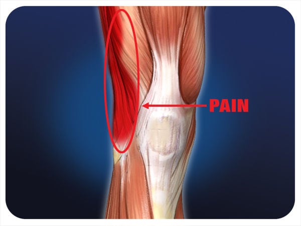 Knee pain when cycling - and how to avoid it - Physio on the River